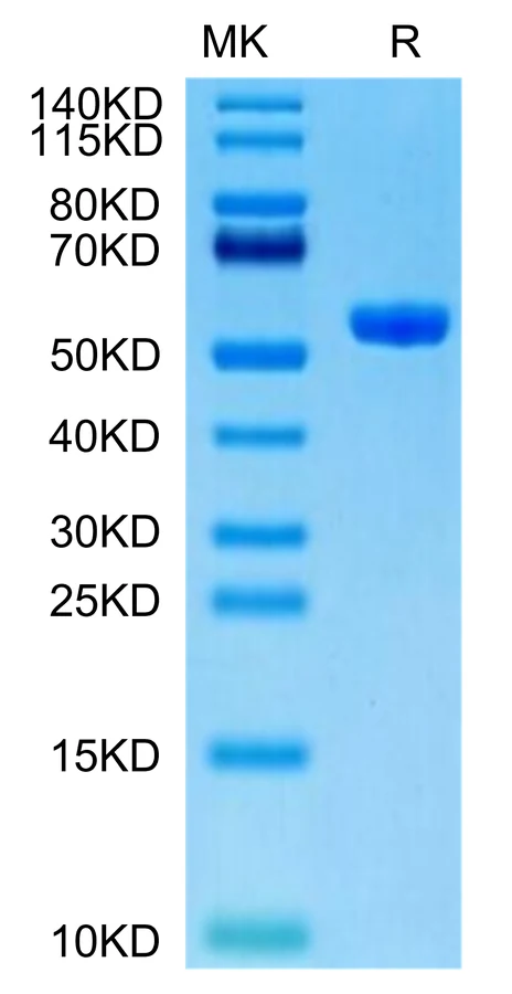 KRASWT-HP007 Bis-Tris-PAGE-white result