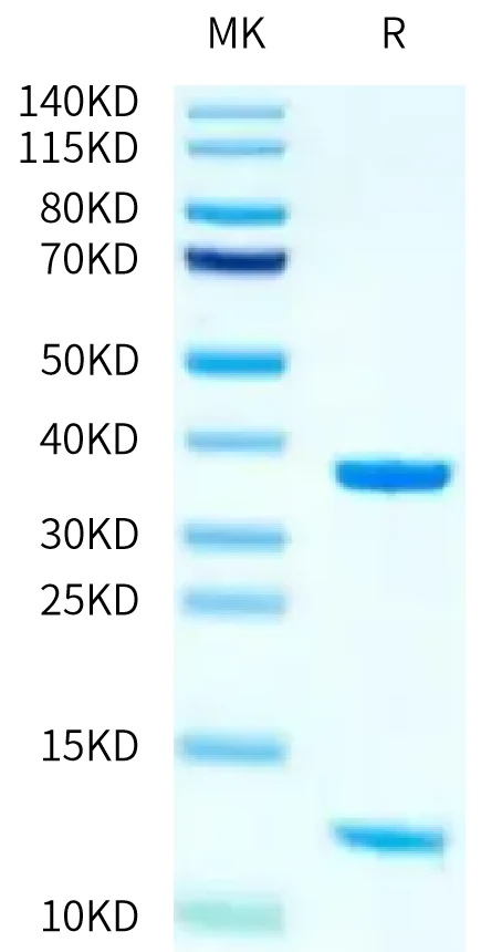 KRASWT-HP008 Bis-Tris-PAGE-white result