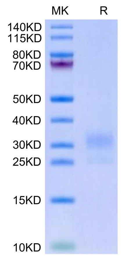 LAIR1-HB001 Bis-Tris-PAGE-white result