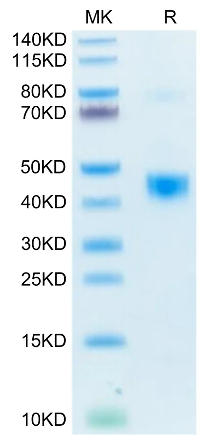LAP-HB001 Bis-Tris-PAGE-white result