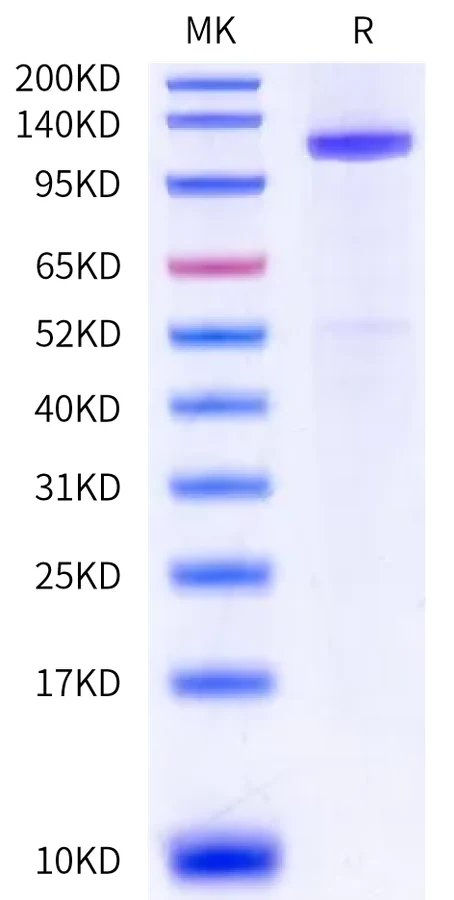 LRP6-HF001 Bis-Tris-PAGE-white result