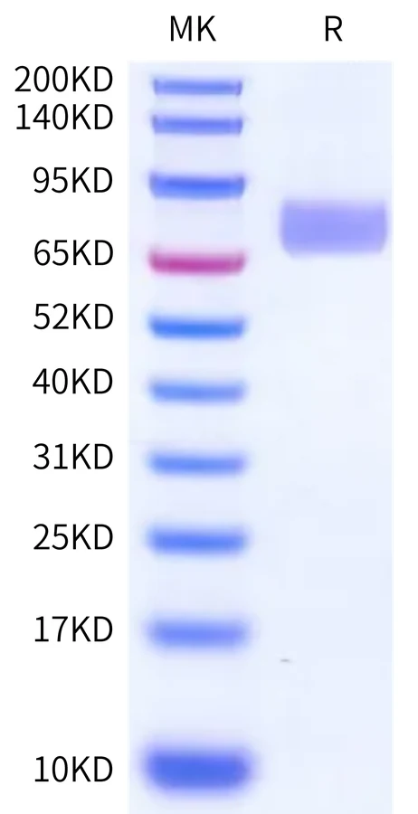 LRRC15-HB001 Bis-Tris-PAGE-white result