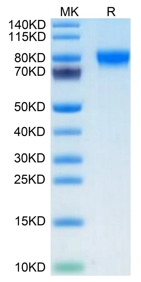 MAG-HB001 Bis-Tris-PAGE result