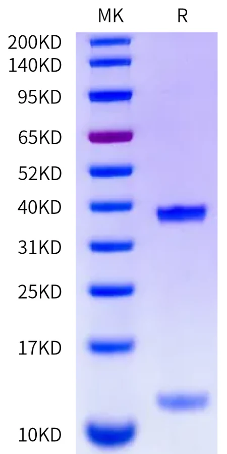 MAGEA1-HB002 Bis-Tris-PAGE-white result