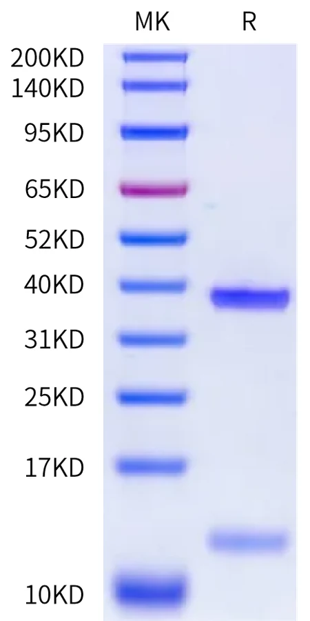 MAGEA1-HP002 Bis-Tris-PAGE-white result