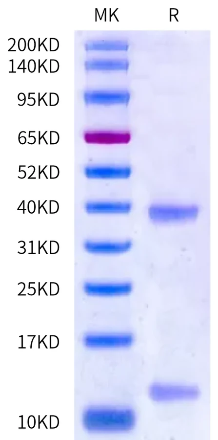 MAGEA3-HB001 Bis-Tris-PAGE-white result