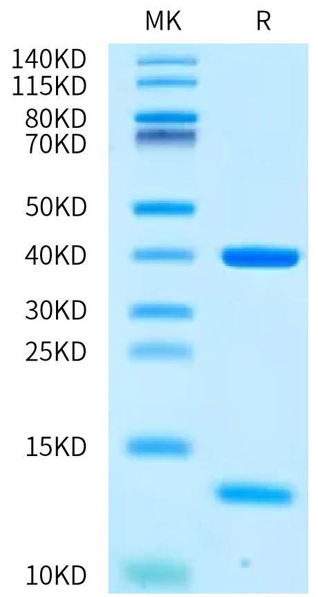 MAGEA4-HB002 Bis-Tris-PAGE-white result