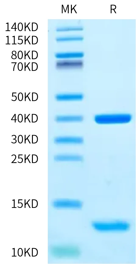 MAGEA4-HP002 Bis-Tris-PAGE-white result