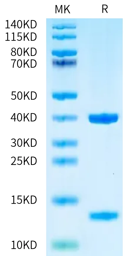 MART1-HB001 Bis-Tris-PAGE-white result