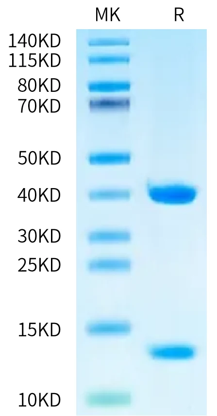 MART1-HB003 Bis-Tris-PAGE-white result