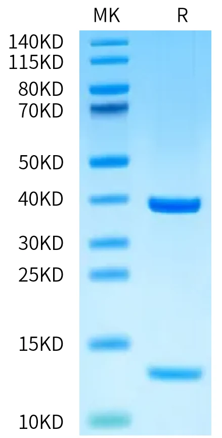 MART1-HP001 Bis-Tris-PAGE-white result