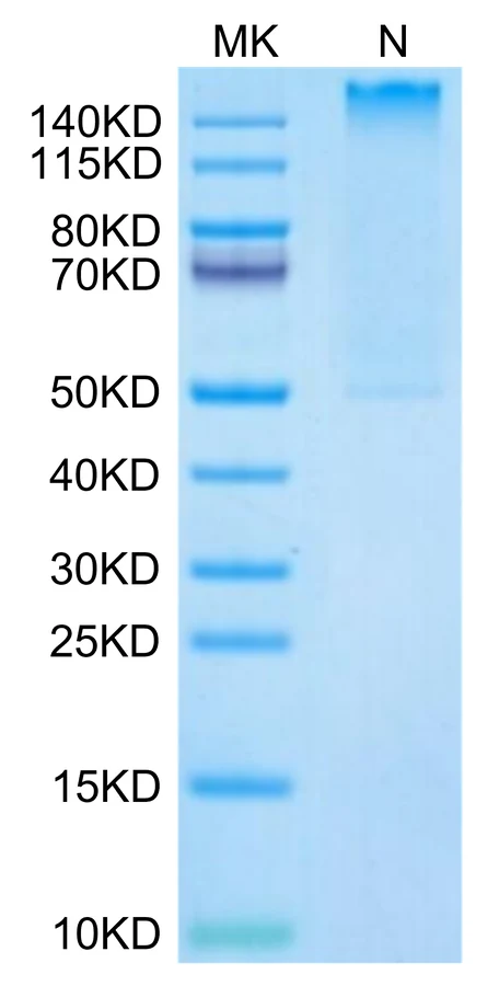 MART1-HP003 Bis-Tris-PAGE-white result