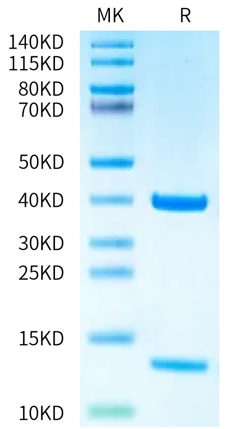 MART1-HP004 Bis-Tris-PAGE-white result