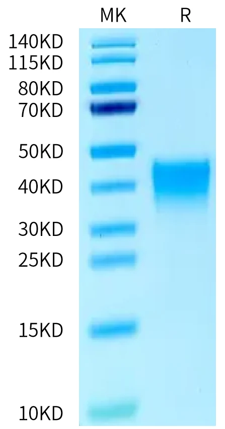 MDL1-MB001 Bis-Tris-PAGE-white result