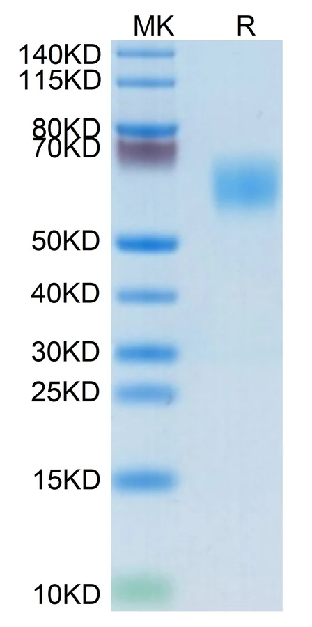 MICA-HB001 Bis-Tris-PAGE result