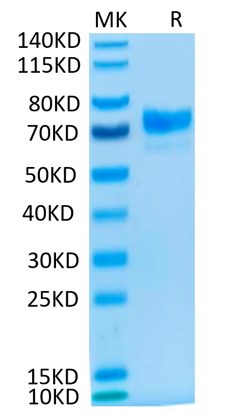MSLN-CF001 Bis-Tris-PAGE result