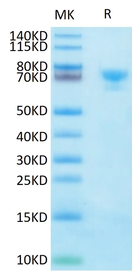 MSLN-HB001 Bis-Tris-PAGE result