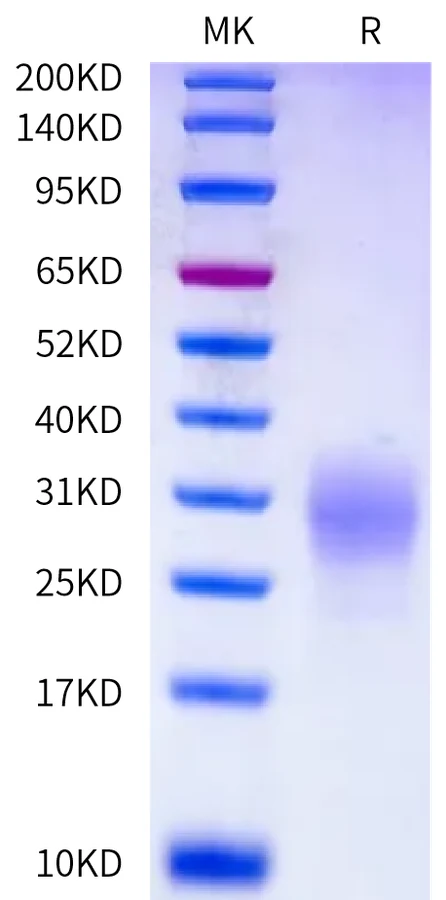 MSLN-HB004 Bis-Tris-PAGE-white result