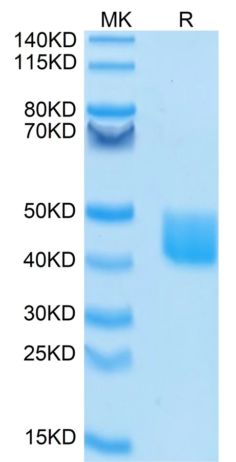 MSLN-HP001 Bis-Tris-PAGE result