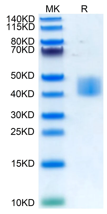 MSLN-HP003 Bis-Tris-PAGE result