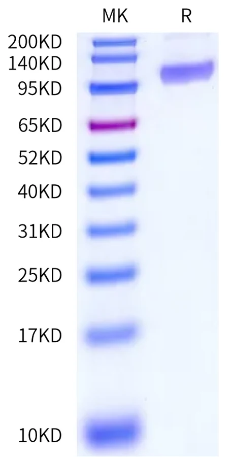 MSR1-HF001 Bis-Tris-PAGE-white result