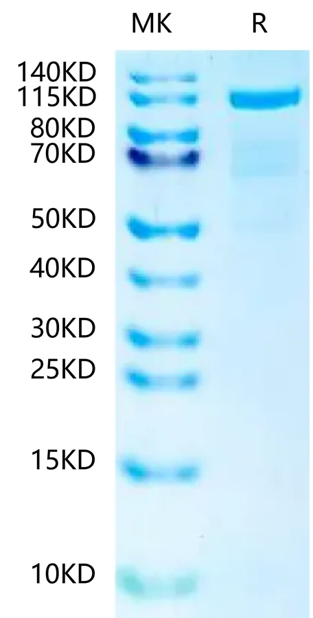 NCADHERIN-HF001 Bis-Tris-PAGE-white result