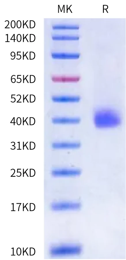 NCR1-HB001 Bis-Tris-PAGE-white result