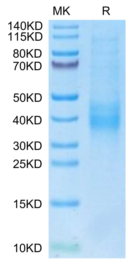 NKG2C-HB002 Bis-Tris-PAGE-white result