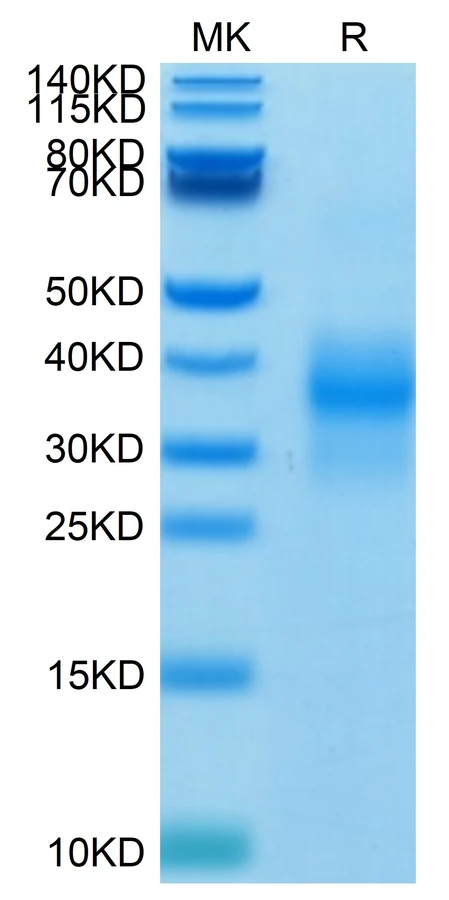 NKG2D-HB001 Bis-Tris-PAGE result