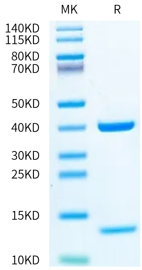NYESO1-HB005 Bis-Tris-PAGE-white result
