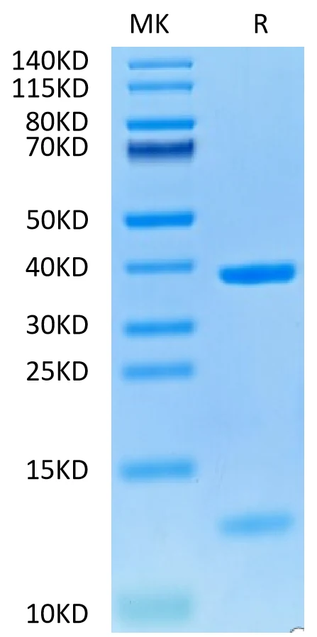 NYESO1-HP001 Bis-Tris-PAGE-white result