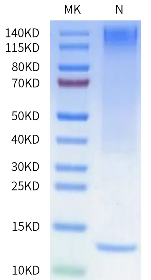 NYESO1-HP004 Bis-Tris-PAGE-white result