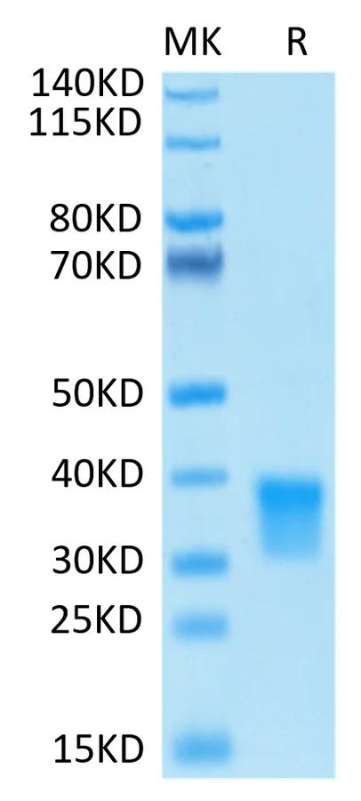 OSM-HB001 Bis-Tris-PAGE-white result