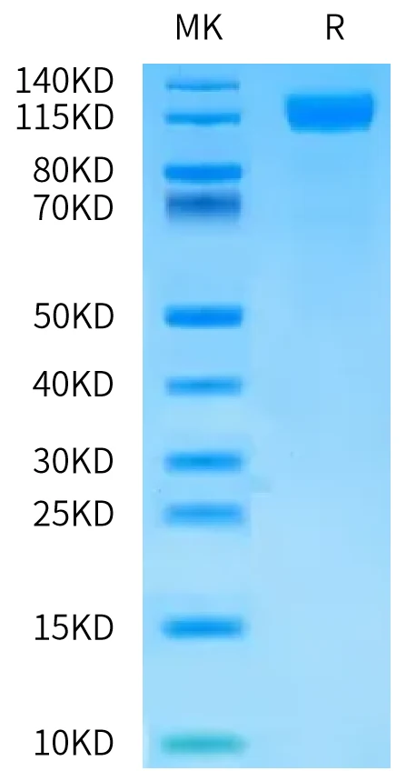 OSMR-HB001 Bis-Tris-PAGE-white result