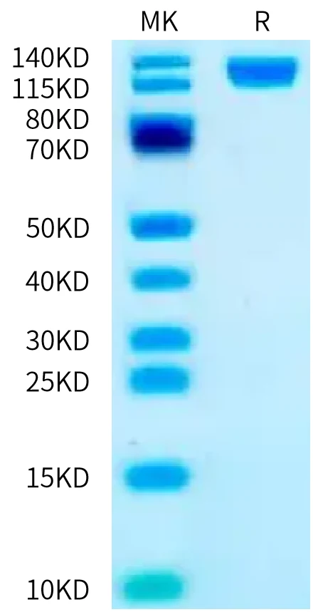 OSMR-HB002 Bis-Tris-PAGE-white result