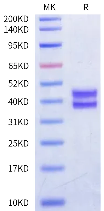 OVA-MB001 Bis-Tris-PAGE-white result