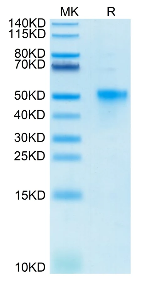 OX40-HB004 Bis-Tris-PAGE result