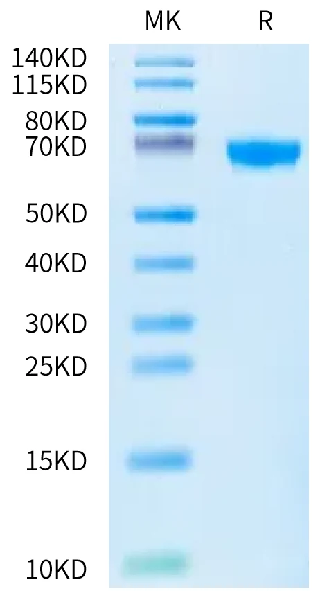 OX40-HP001 Bis-Tris-PAGE-white result