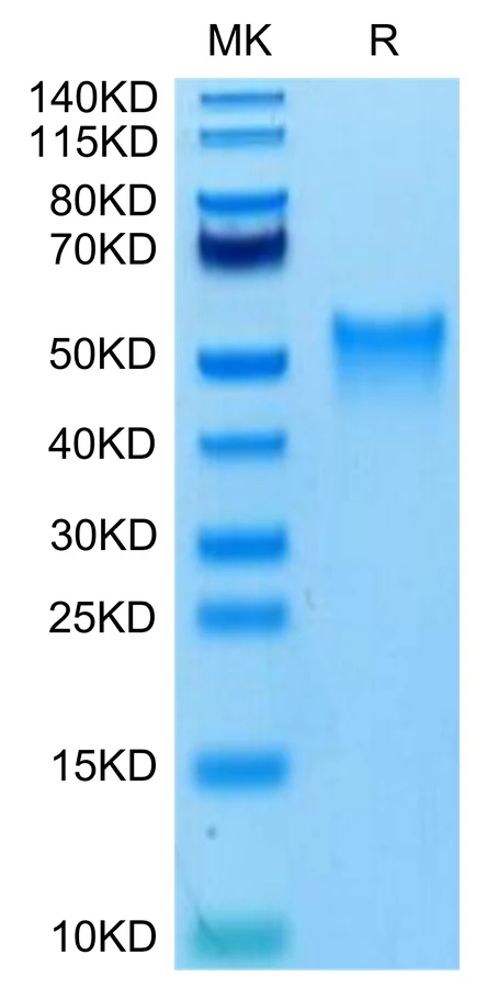 OX40-MB002 Bis-Tris-PAGE-white result