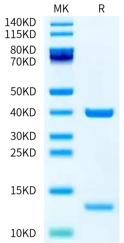 P53R175H-HB001 Bis-Tris-PAGE-white result