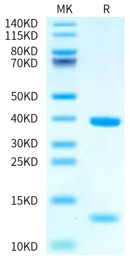 P53R175H-HP002 Bis-Tris-PAGE-white result