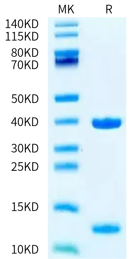 P53WT-HB001 Bis-Tris-PAGE-white result