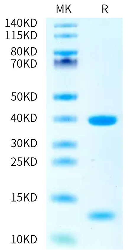 P53WT-HP001 Bis-Tris-PAGE-white result