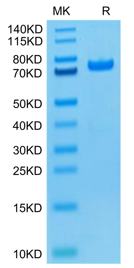 PADI4-HB001 Bis-Tris-PAGE-white result