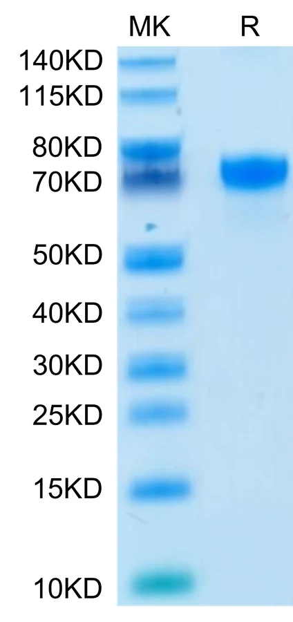 PDL1-HP006 Bis-Tris-PAGE-white result