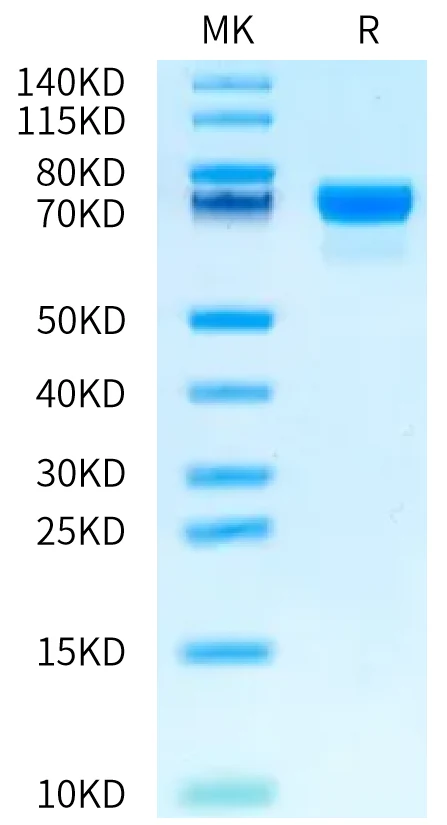 PDL1-HP009 Bis-Tris-PAGE-white result