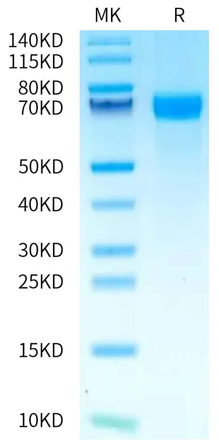 PDL2-HF001 Bis-Tris-PAGE-white result