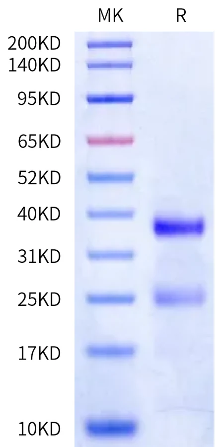 PLAU-HB001 Bis-Tris-PAGE-white result