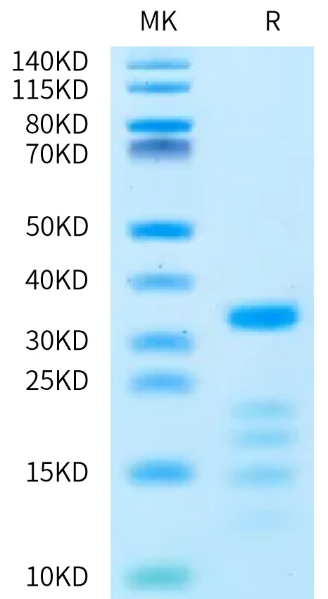 PLAU-MB001 Bis-Tris-PAGE-white result