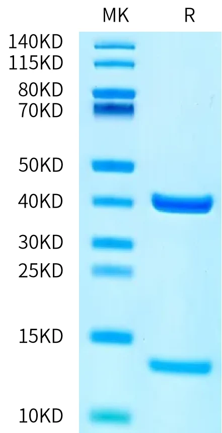 PRAME-HB004 Bis-Tris-PAGE-white result